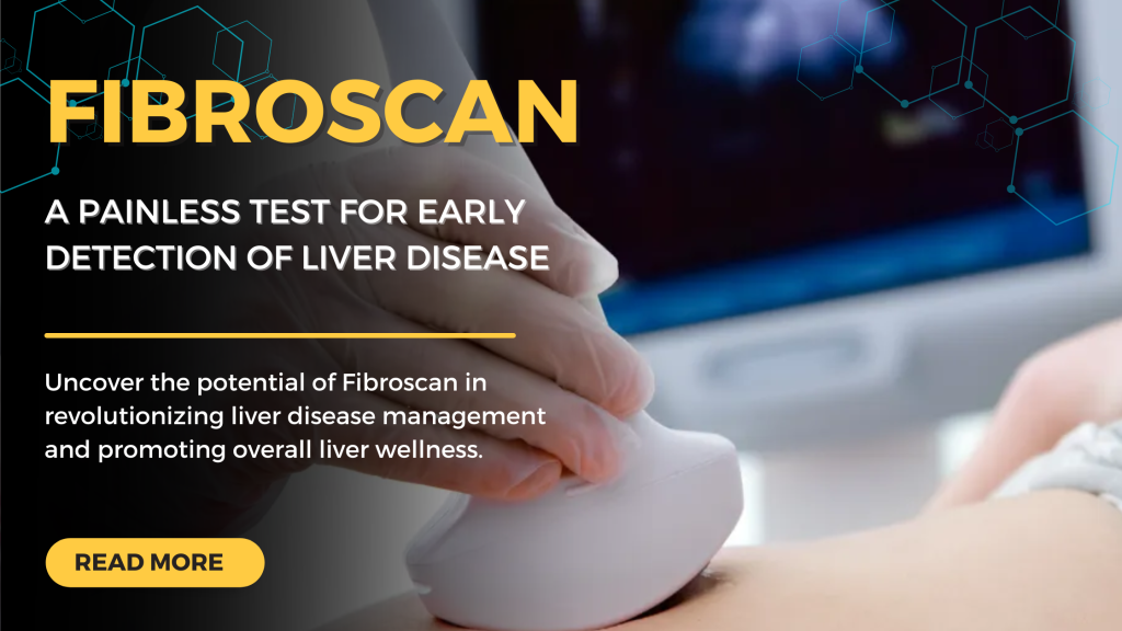 Fibroscan: A Painless Test for Early Detection of Liver Disease